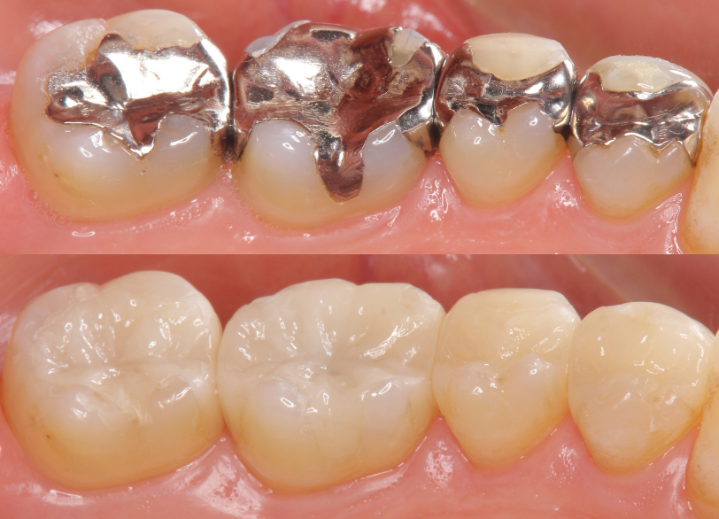 審美治療 | 蓮田市の歯医者 内村歯科医院（予防歯科・小児歯科・高度治療）