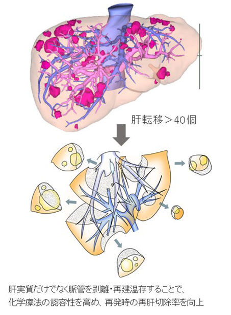 肝・胆・膵外科｜臨床｜岡山大学大学院医歯薬学総合研究科 消化器外科学