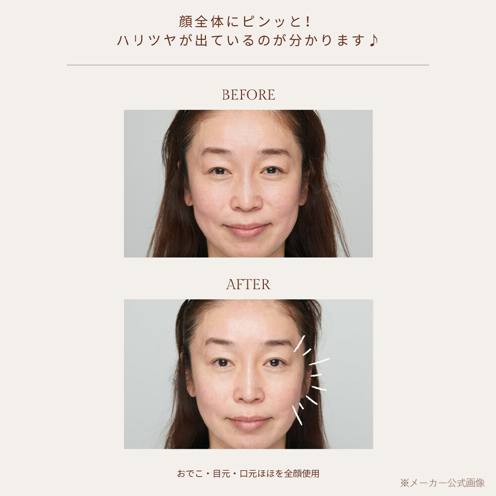 楽天市場】【20％OFFクーポン！】BEETOX ハリツヤ特化型 ゲルパッチ