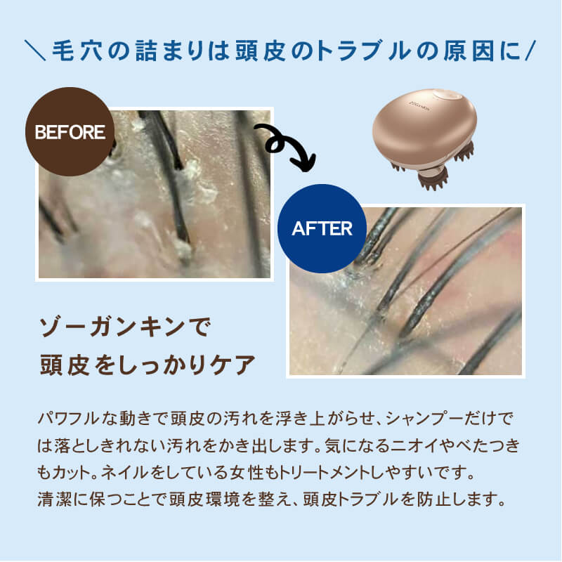 楽天市場】【正規品/送料無料/あす楽】ゾーガンキンスカルプ EMS