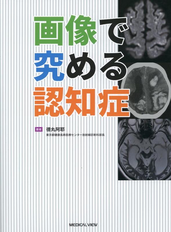 楽天ブックス: 武器としての神経症候・高次脳機能障害の診かた 高次は