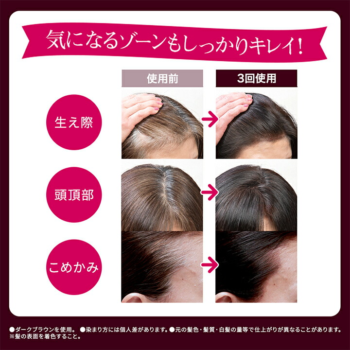 楽天市場】【店内P最大65倍以上開催】【DHC直販】DHC Q10プレミアム