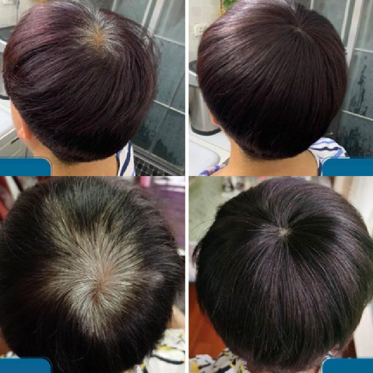 楽天市場】部分ウィッグ つけ毛 トップピース ヘアピース 人毛100