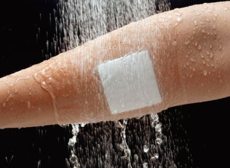 楽天市場】マルチフィックス・ロール 5.0cm×10m 5号 アルケア 透湿