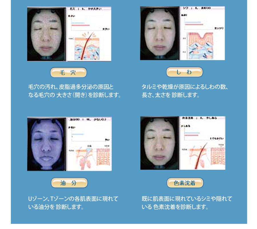 楽天市場】【肌診断機器】A-ONE Lite（エイ・ワン・ライト）/エーワン