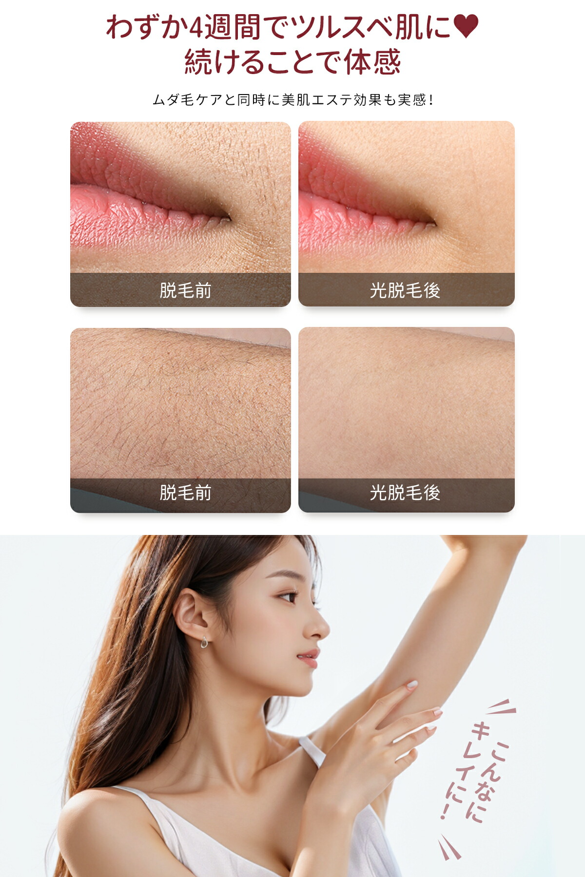 楽天市場】【即納】「Y-KINZ ICE-CLEAR IPL光脱毛器 - 冷却機能搭載