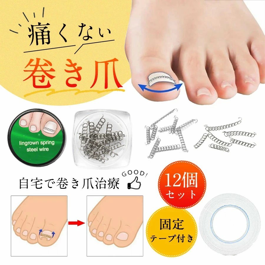 楽天市場】巻き爪 矯正 巻き爪チェーン 治療 爪ワイヤー テープ付き 12