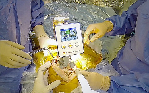 人工膝関節・肩関節鏡手術（専門医による最先端手術） | 芦屋セント