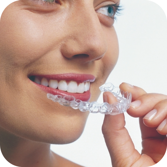 マウスピース型矯正装置（クリアアライナー・インビザライン） - イー