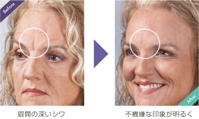 インスタント顔面補修メイク ダーマフラージ | 株式会社アイキャッチは