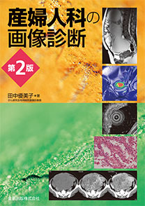 産婦人科の画像診断 第2版 | 金原出版