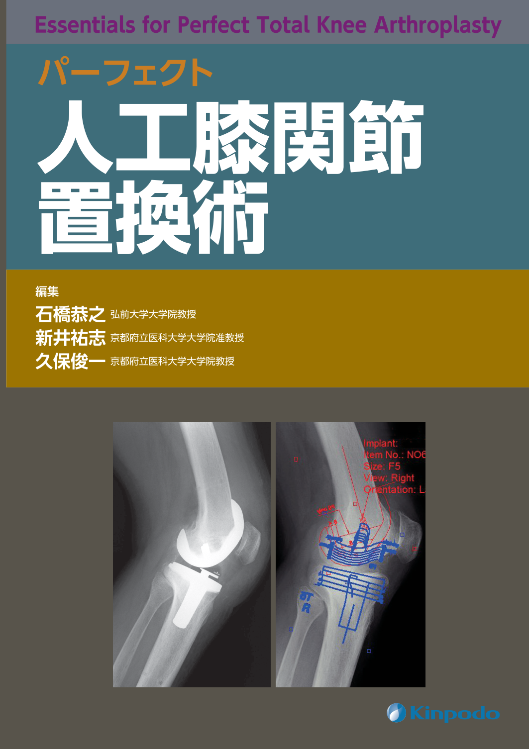 パーフェクト人工膝関節置換術 - 株式会社 金芳堂
