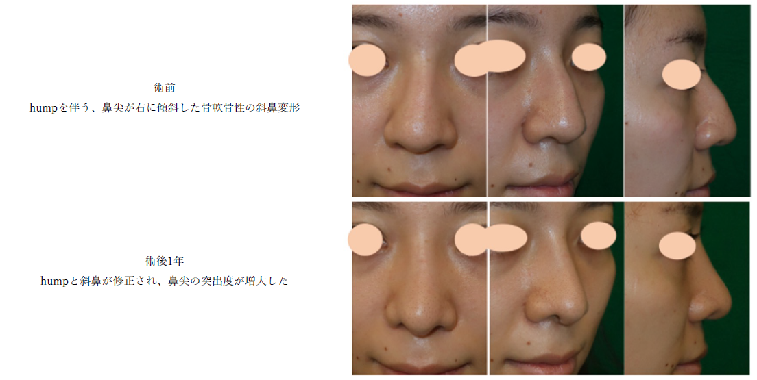 鼻中隔外鼻クリニック（Septorhinoplasty Clinic）｜診療部門・中央