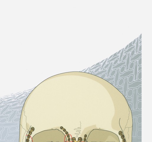 AO法骨折治療 頭蓋顎顔面骨の内固定訳－外傷と顎矯正手術』 立ち読み