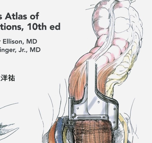 ゾリンジャー外科手術アトラス 2版訳』 立ち読み