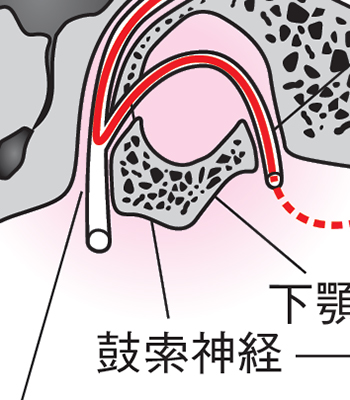 口腔外科学 第4版 正誤表／補足情報／医歯薬出版株式会社