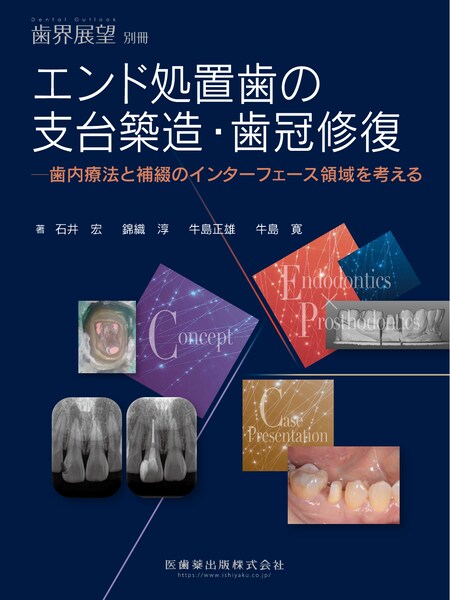 エビデンス×臨床判断から導く実践的歯周治療／医歯薬出版株式会社