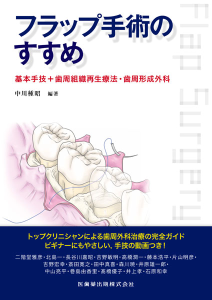 フラップ手術のすすめ 基本手技＋歯周組織再生療法・歯周形成外科／医