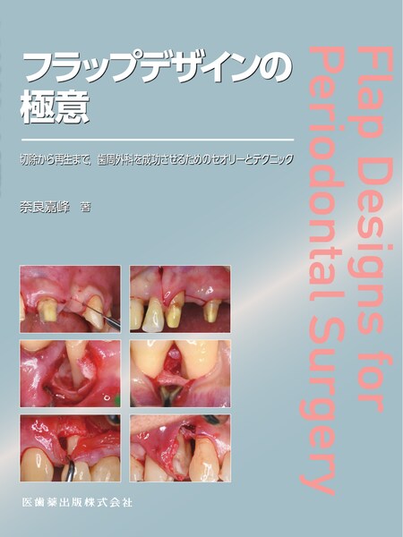 臼歯部コンポジットレジン修復 MI時代の臨床戦略／医歯薬出版株式会社