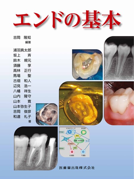 エンドの基本／医歯薬出版株式会社