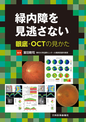 緑内障を見逃さない 眼底・OCTの見かた – 日本医事新報社