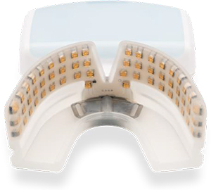 ♡OrthoPulse 矯正治療サポートデバイス OrthoPulse 矯正治療サポート