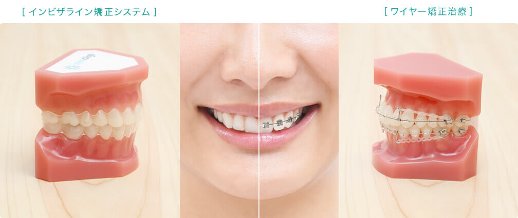 インビザライン・光加速矯正 - 【公式】沖縄の歯科矯正 おきなわ矯正歯科