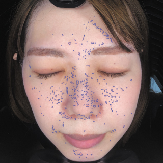 Aroma＆Total beauty salon/Fruit café noe｜肌分析マシン FACE-DX9