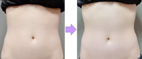 ノンFドラゴン | ノンエフドラゴン詰め替え用 500g