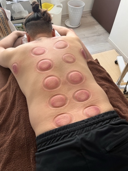 腰痛からの復活（院長の場合） - 体の力み・食いしばりを取る整体