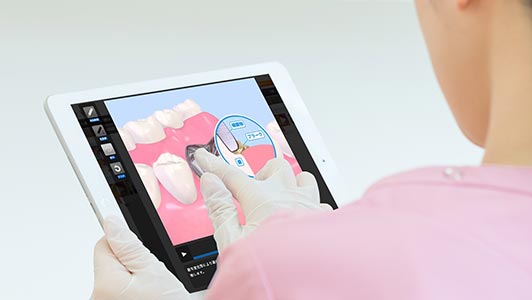 製品情報 | 株式会社ナルコーム