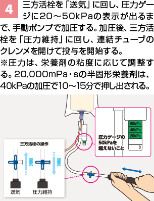 PG加圧バッグⅡ | PG加圧バッグⅡ | ニュートリー株式会社