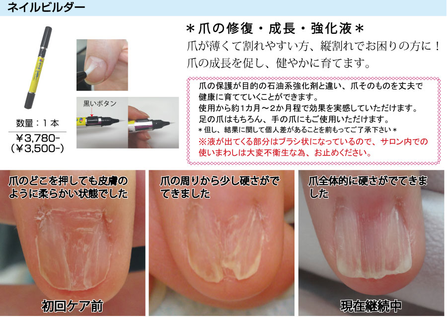 爪の修復・成長・強化液/ネイルビルダー（ペディグラス）