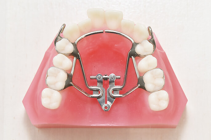 小児矯正（顎顔面矯正） | 日野市万願寺の歯医者 医療法人社団駿匠会