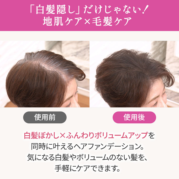 アートミクロンモアモアプラス 特別セット｜テレ東マート