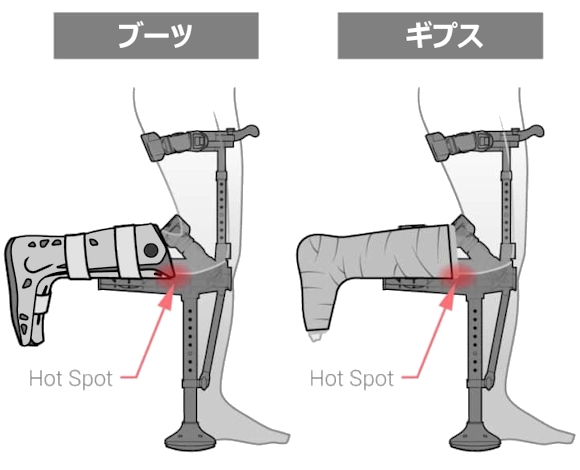 アイウォーク3.0（iWALK3.0）[ハンズフリー松葉杖・二-クラッチ]のご