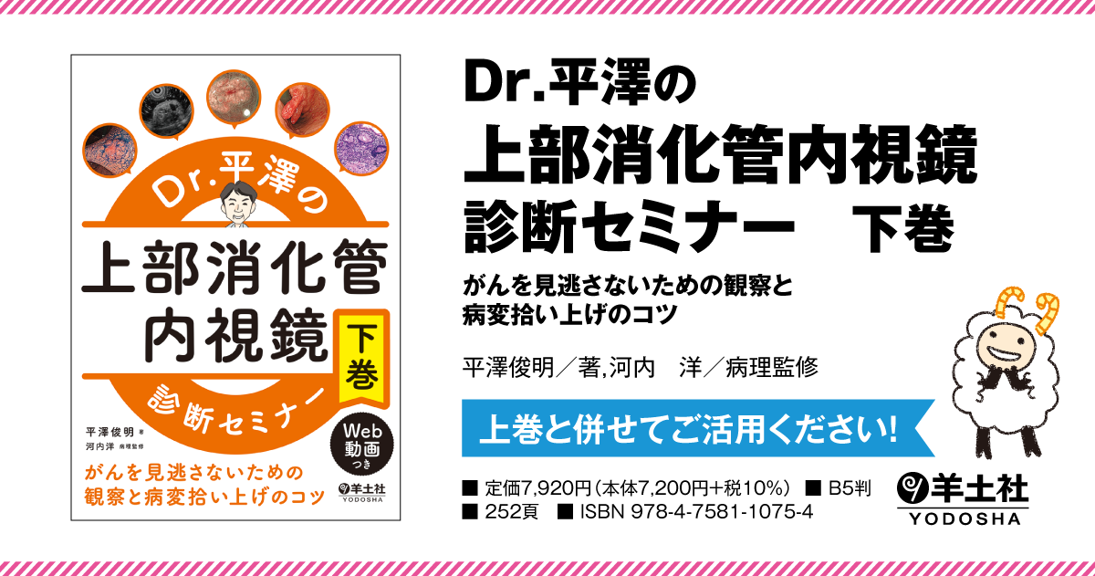 Dr.平澤の上部消化管内視鏡診断セミナー 下巻〜がんを見逃さないための
