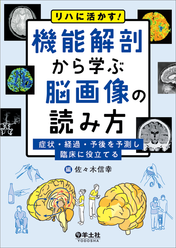 リハに活かす！機能解剖から学ぶ脳画像の読み方〜症状・経過・予後を