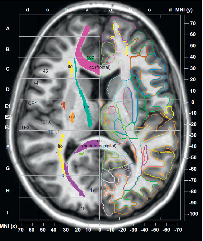 白質に関連するMRIの用語について｜くろ 作業療法士