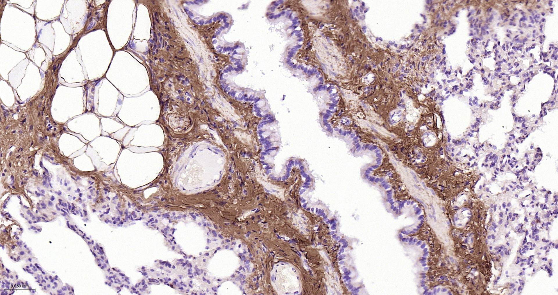 Collagen I Polyclonal Antibody – Bioss