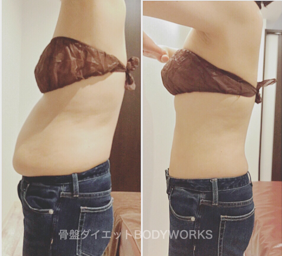 痩せてきました～～！！体重-7㎏・ウエスト-10㎝骨盤ダイエット