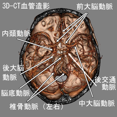 脳血管の解剖 - 動脈系 | 福岡の脳神経外科 - はしぐち脳神経クリニック