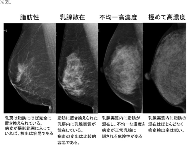 研究成果物 | 乳がん検診の適切な情報提供に関する研究 ｜ 福井県