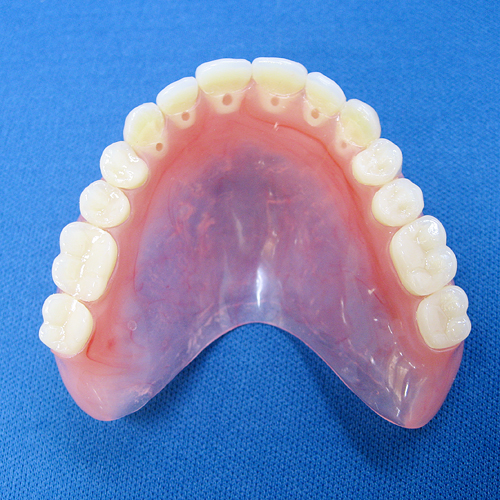 ノンクラスプデンチャー Non-Clasp Denture ::::: デンチャー専門ラボ