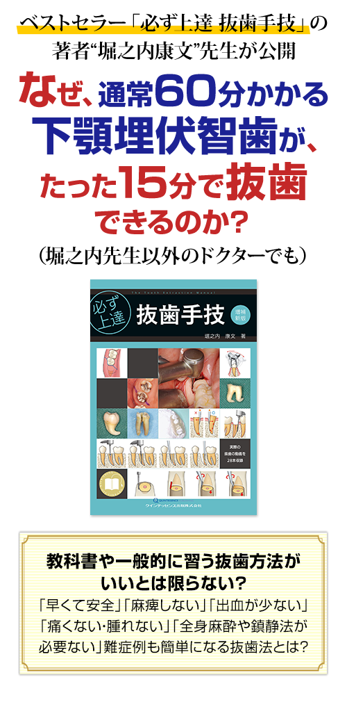 株式会社 医療情報研究所 | 難症例も単純化！学校では教えてくれない抜歯術