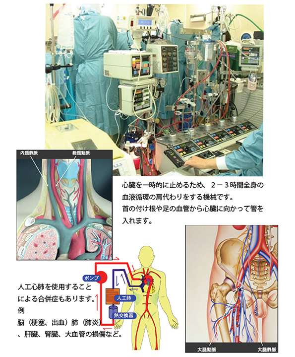 心臓弁膜症の治療｜心臓血管外科医 渡邊剛公式サイト