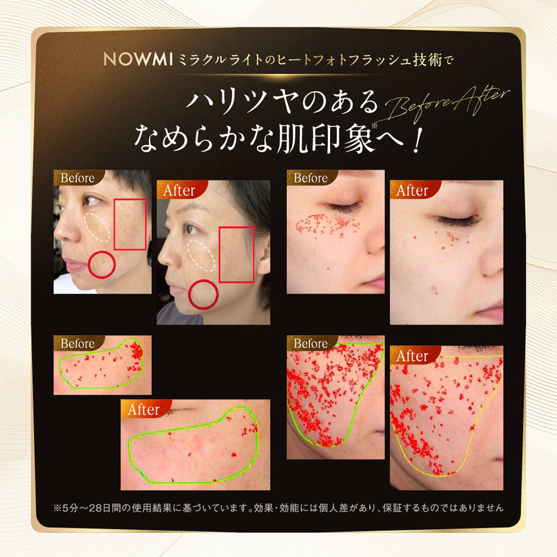 ヒートフォトケア美顔器 NOWMI LAB ミルクライト PIR 360