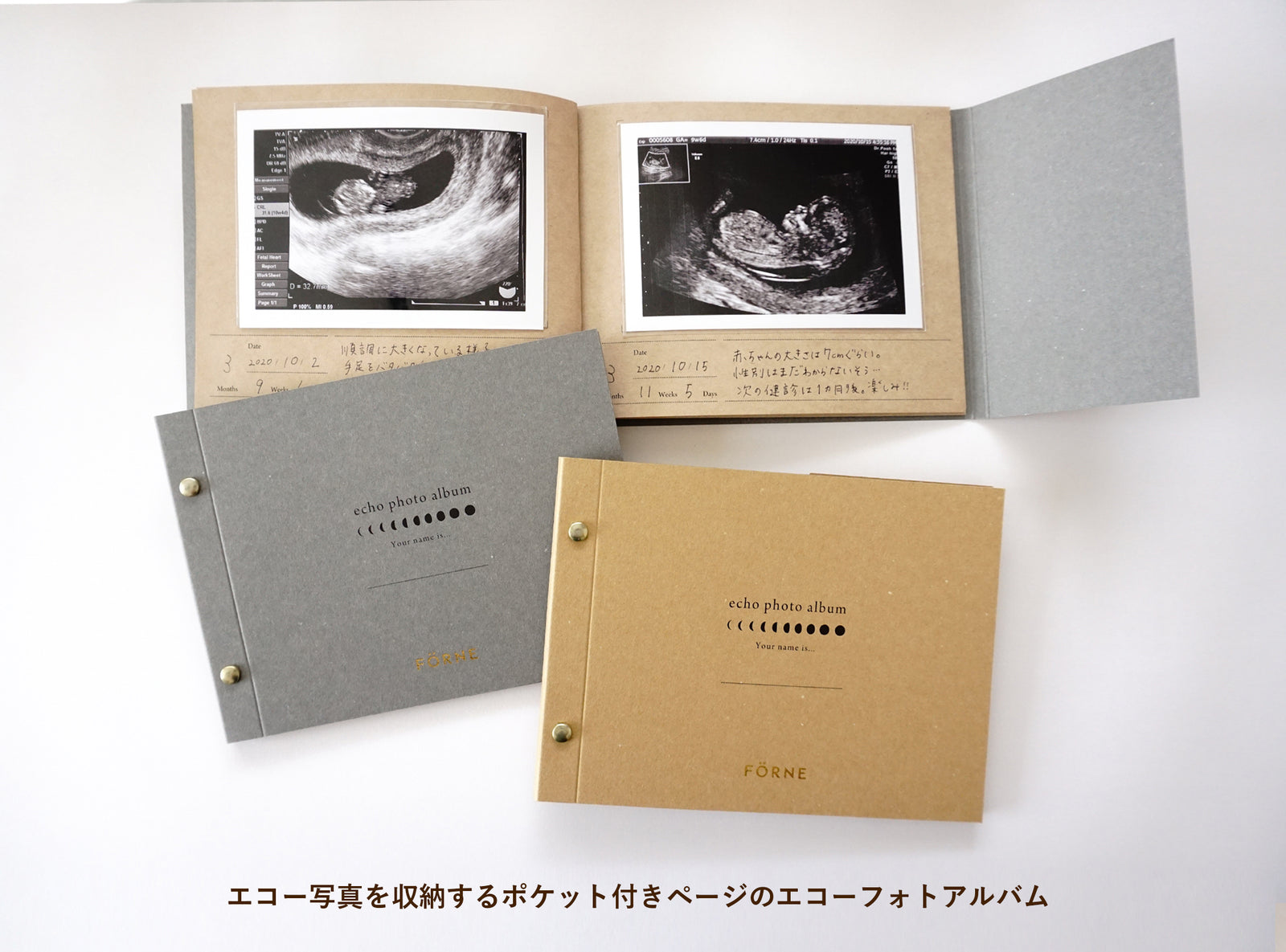 エコーフォトアルバム シンプル 縦13.8cm×横18.3cm×厚み約0.8cm L判