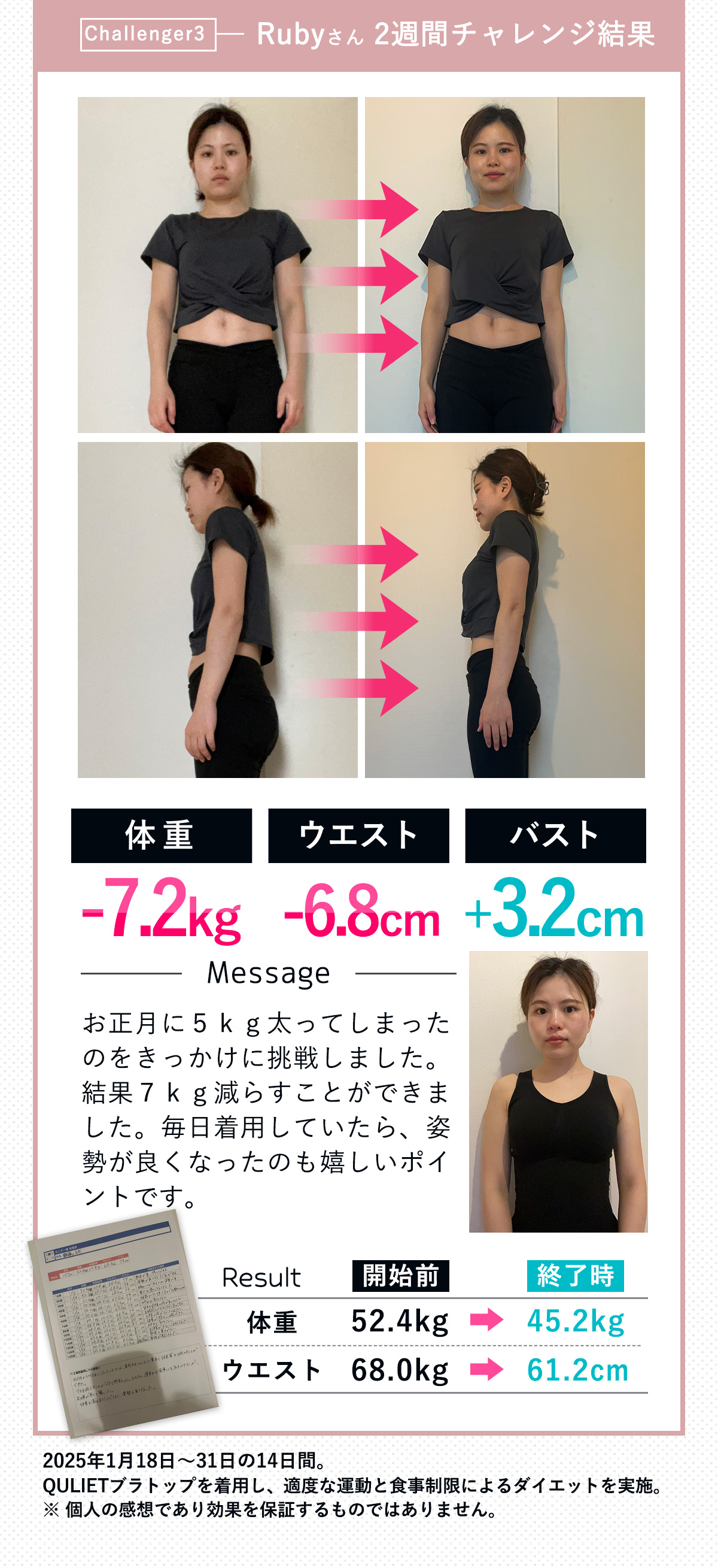 キュリエットブラトップ（Quliet BraTop）| トータルケア着圧ブラ