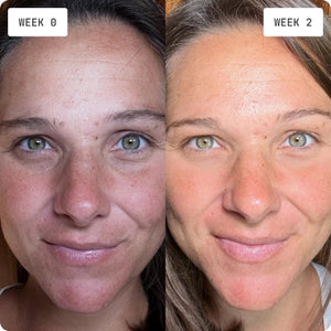 GENIX Beauty | Placenta Cream for Youthful Face and Bright Eyes